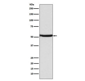 Western blot testing of lysate from human Jurkat cells treated with etoposide and TSA, with acetyl-p