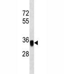 EpCAM Antibody, 0.08ml