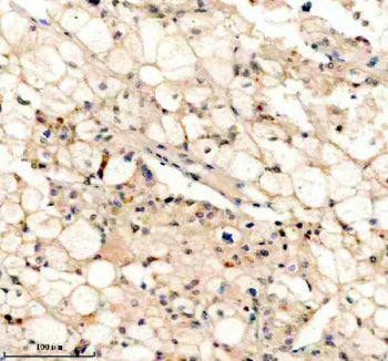 PEX5 Antibody / Peroxisomal biogenesis factor 5, 100ug