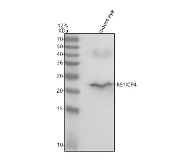 Western blot analysis of Retinoschisin using anti-Retinoschisin antibody. Lane 1: mouse eye tissue l