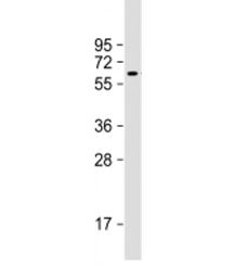 Western blot testing of MCF7 cell lysate with YES1 antibody at 1:4000. Predicted molecular weight: 6