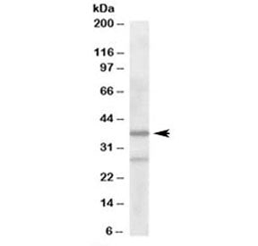 Western blot testing of human liver lysate with ARPC1B antibody at 2ug/ml. Predicted molecular weigh