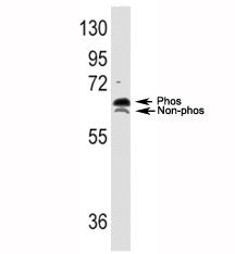 p70 S6 Kinase alpha Antibody (RPS6KB1)