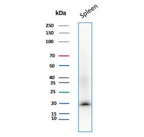 Western blot testing of human spleen tissue with Stathmin 1 antibody (clone STMN1/8437). Predicted m