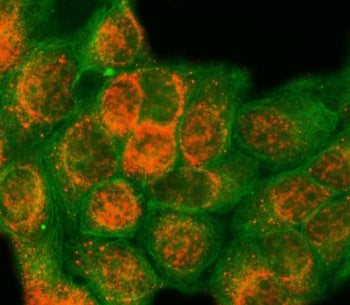 Immunofluorescent staining of FFPE human MCF7 cells with SAP18 antibody (red) and Alpha Tubulin mAb