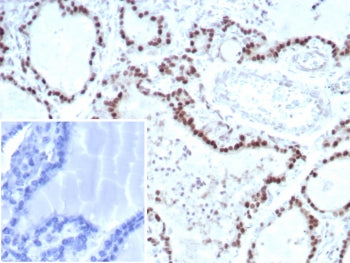 IHC staining of FFPE human thyroid tissue with Transcription factor E3 antibody; Nuclear staining ob