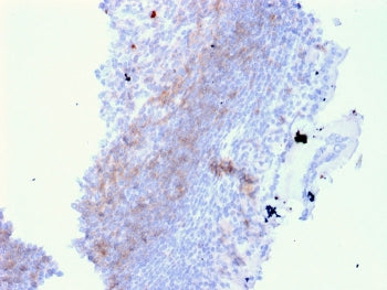 IHC staining of FFPE human lymph node with CD72 antibody (clone BU40). HIER: boil tissue sections in