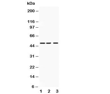 Western blot testing of ANGPTL4 antibody and Lane 1: human placenta; 2: SMMC-7721; 3: HeLa lysate. P