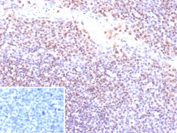 IHC staining of FFPE human tonsil tissue with recombinant EBV antibody (clone EBV/9620R). Inset: PBS