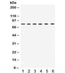 Western blot testing of 1) rat heart, 2) rat kidney, 3) rat brain, 4) human SMMC, 5) human PANC and