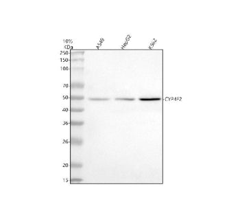 Western blot analysis of CYP4F2 using anti-CYP4F2 antibody. Lane 1: human whole cell lysates, Lane 2