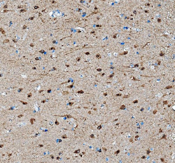 IHC testing of FFPE mouse brain tissue with SAP102 antibody at 1ug/ml. Required HIER: steam section