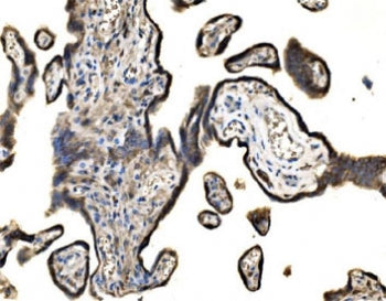 SND1 Antibody / Staphylococcal nuclease domain-containing protein 1 antibody / TDRD11