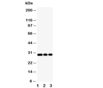 Western blot testing of HLA-DM antibody and Lane 1: Jurkat; 2: Raji; 3: HUT cell lysate
