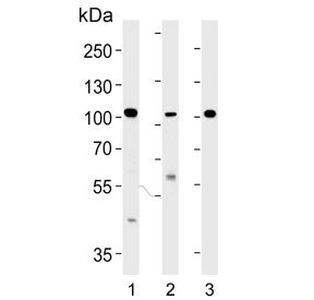 Western blot testing of 1) human Hela, 2) human MDA-MB-453 and 3) mouse kidney lysate with NCOA7 ant