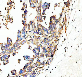 Immunohistochemical staining of SPON1 using anti-SPON1 antibody. SPON1 was detected in a paraffin-em