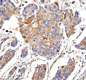 IHC analysis of PHLDB3 using anti-PHLDB3 antibody. PHLDB3 was detected in a paraffin-embedded sectio