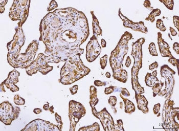 IHC staining of FFPE human placental tissue with PKI beta antibody. HIER: boil tissue sections in pH