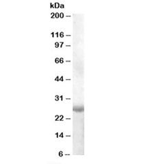 Western blot testing of human muscle lysate with APOBEC2 antibody at 1ug/ml. Predicted molecular wei