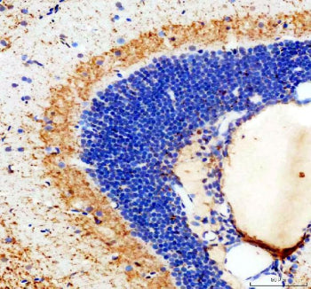 IHC staining of FFPE zebrafish brain tissue with Zebrafish Stat3 antibody, HRP-labeled secondary and