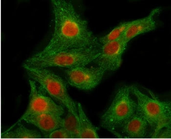 POLR2B Antibody / DNA-directed RNA polymerase II subunit RPB2