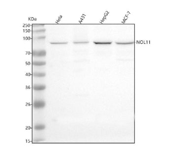 Western blot analysis of NOL11 using anti-NOL11 antibody. Lane 1: human Hela whole cell lysates, Lan