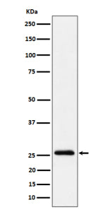 Western blot analysis of INMT/TEMT expression in human A549 cell lysate using INMT antibody. Predict