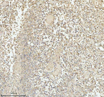 Immunohistochemical staining of PACSIN1 using anti-PACSIN1 antibody. PACSIN1 was detected in a paraf