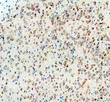 IHC staining of FFPE rat brain tissue with CGRP antibody, HRP-secondary and DAB substrate. HIER: boi