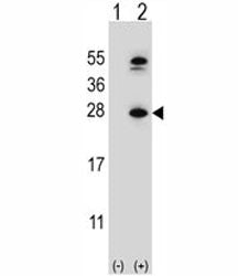 Western blot analysis of DHFR antibody and 293 cell lysate either nontransfected (Lane 1) or transie