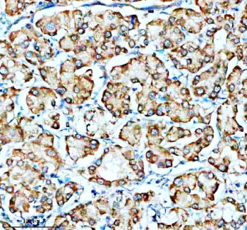 Immunohistochemical staining of SMG8 using anti-SMG8 antibody. SMG8 was detected in a paraffin-embed