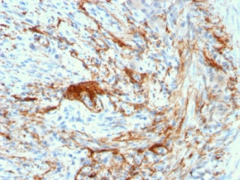 IHC testing of FFPE human small intestine with recombinant Elastin antibody (clone ELN/3131R). Requi