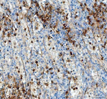IHC staining of FFPE human spleen tissue with ANGPTL4 antibody. HIER: boil tissue sections in pH8 ED