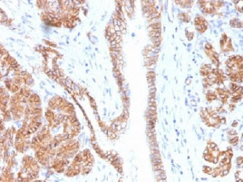 IHC testing of FFPE human pancreas tissue with Beta Catenin antibody (clone CTNNB1/1508). Required H