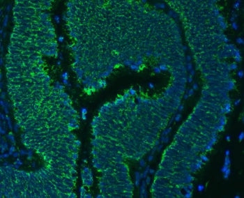 SLC25A24 Antibody / Mitochondrial ATP-Mg/Pi carrier protein 1