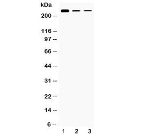 Western blot testing of 1) rat testis, 2) mouse Hepa1-6 and 3) human HepG2 lysate with TECTA antibod
