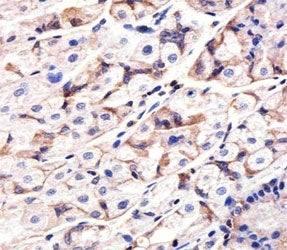 Epidermal Growth Factor Receptor Antibody
