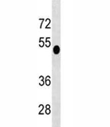 DUSP6 antibody western blot analysis in CEM lysate. Predicted molecular weight 42/26 kDa (isoform 1/