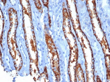 IHC staining of FFPE human kidney tissue with IL20R alpha antibody (clone IL20RA/1752). HIER: boil t