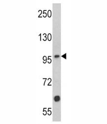 MUSK Antibody