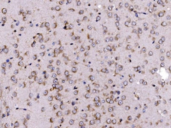 FKBP15 Antibody / FKBP133