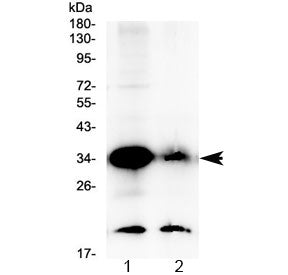 GDF15 Antibody