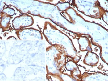IHC staining of FFPE human tonsil tissue with recombinant ALPP antibody (clone ALPP/9109R). Inset: P