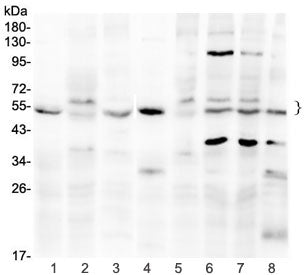 SMAD1 / SMAD5 Antibody
