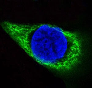 Cytokeratin 14 Antibody / CK14 / KRT14