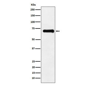 PAK4/5/6 Antibody (pS474/pS560/pS602)