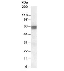 Western blot testing of human skeletal muscle lysate with BIN1 antibody at 0.1ug/ml. Expected molecu