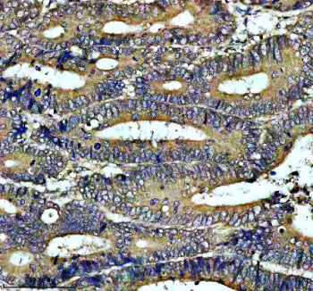 IHC analysis of PIWIL3 using anti-PIWIL3 antibody. PIWIL3 was detected in a paraffin-embedded sectio