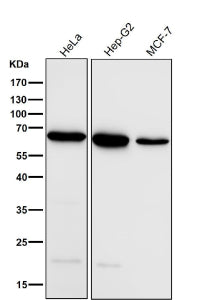 All lanes use the ACADVL antibody at 1:5000 dilution for 1 hour at room temperature. Predicted molec