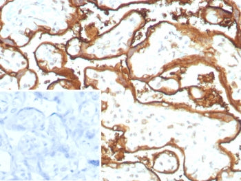 EGF Receptor / EGFR Antibody